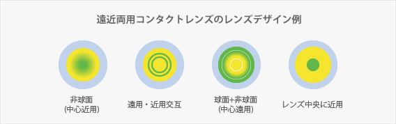 遠近両用コンタクトレンズのレンズデザイン例：非球面（中心近用）、遠用・近用交互、球面+非球面（中心遠用）、レンズ中央に近用