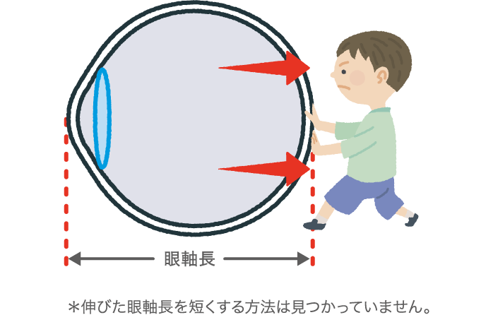 眼軸長の図