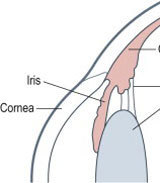 角膜と強膜の間の様子