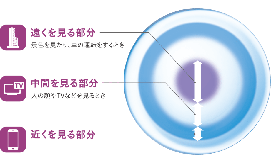 バランスド プログレッシブ テクノロジー - レンズの構成イメージ図