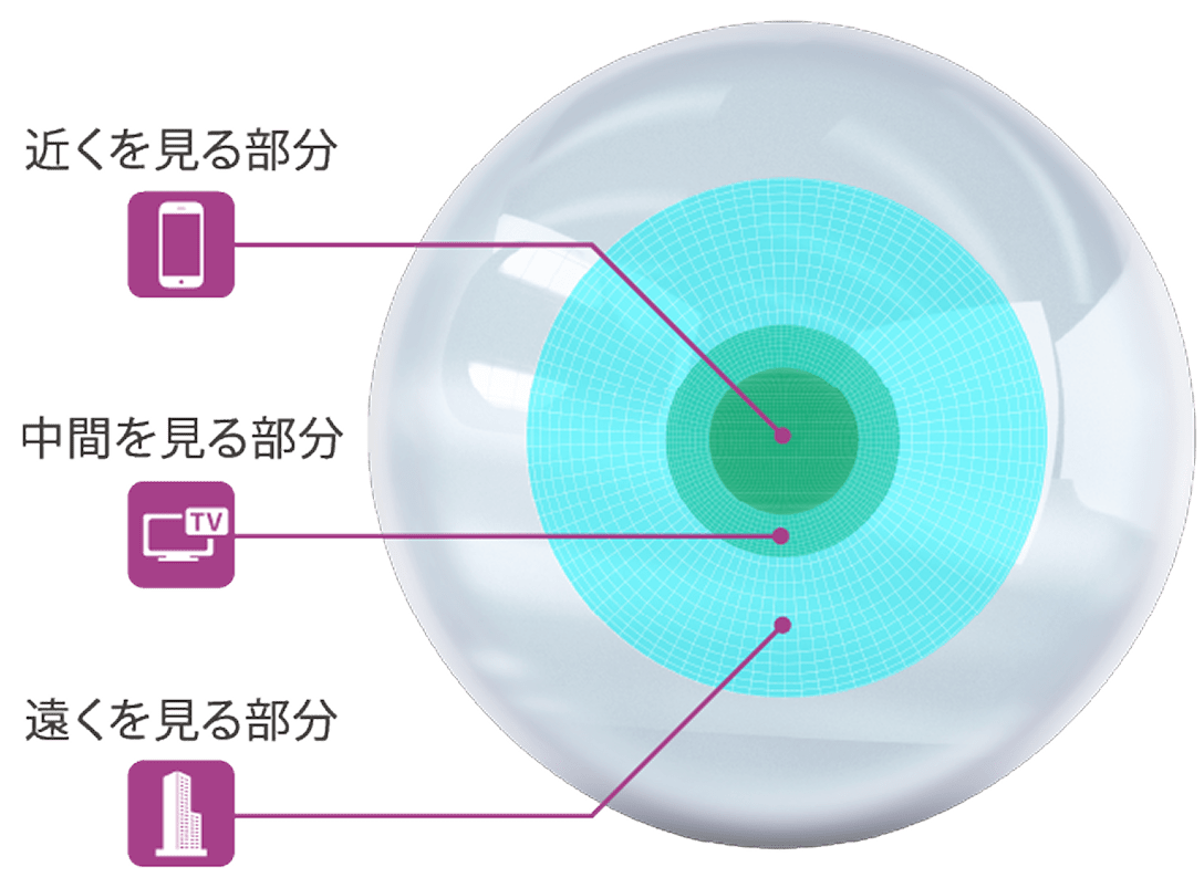 従来の球面レンズでの見え方 イメージ図
